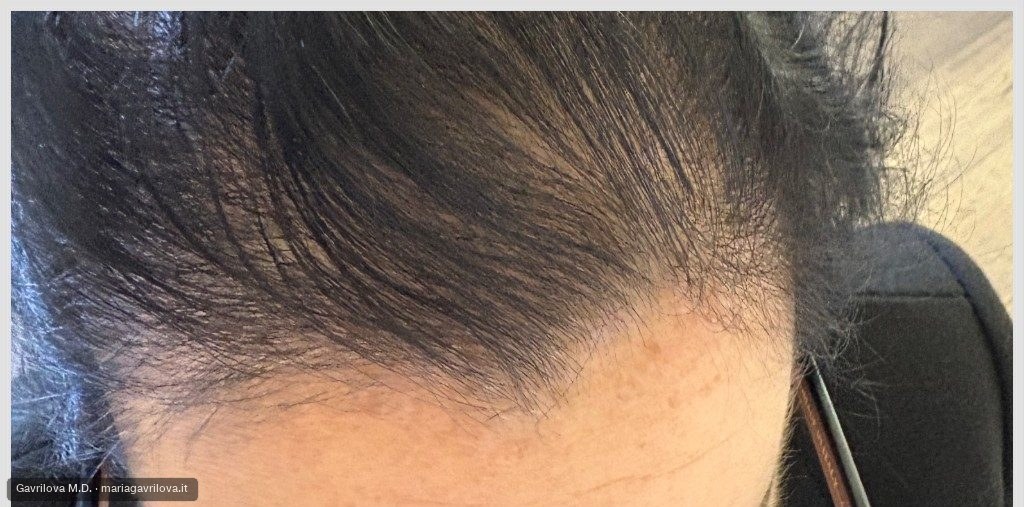 Capelli, prima del trattamento