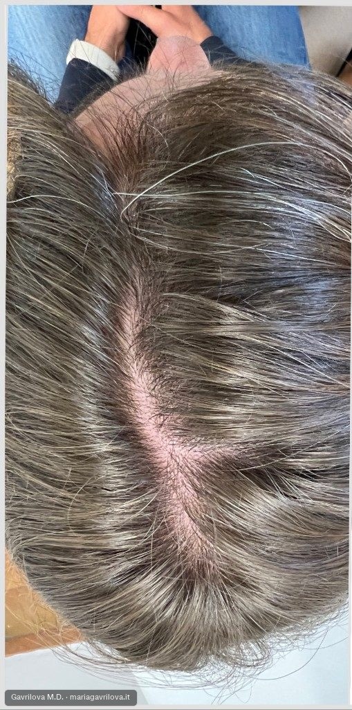 Capelli, prima