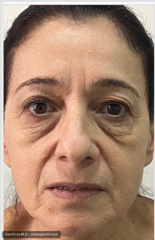 Viso, prima del trattamento